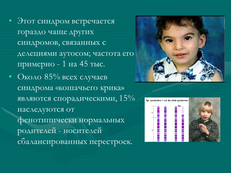 Этот синдром встречается гораздо чаще других синдромов, связанных с делециями аутосом; частота его примерно